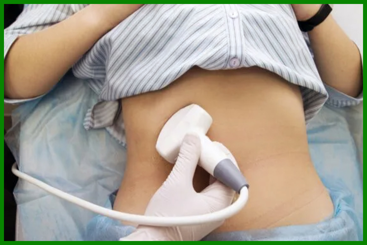 Ecografie abdominală - 